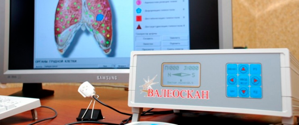 Валео-технология
