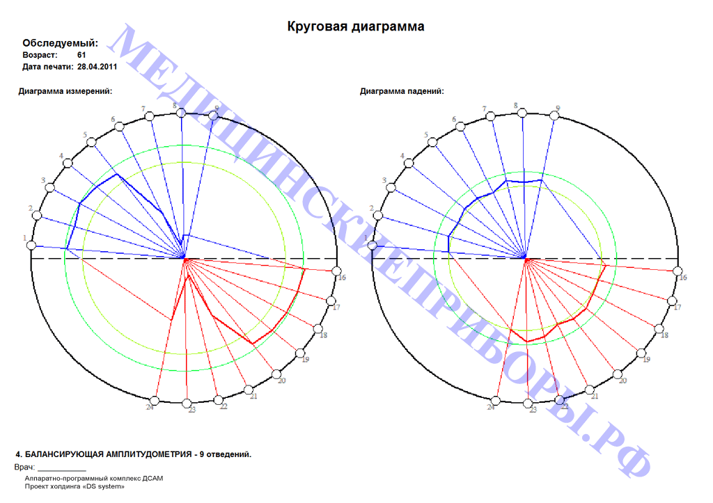 Круговая диаграмма DSAM